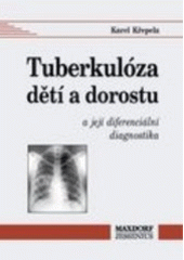 kniha Tuberkulóza dětí a dorostu a její diferenciální diagnostika, Maxdorf 1995