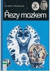 kniha Řezy mozkem neuroanatomie, CT, NMR, Alberta 1993