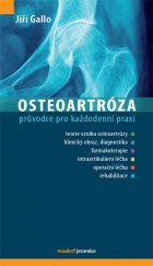 kniha Osteoartróza, Maxdorf 2014