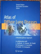 kniha Atlas of Diffuse Lung Diseases A multidisciplinary approach , Springer 2017