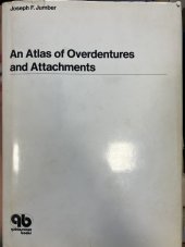 kniha An Atlas of Overdentures and Attachments, Quintessence Books 1981