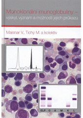 kniha Monoklonální imunoglobuliny - výskyt, význam a možnosti jejich průkazu, Nucleus HK 2012