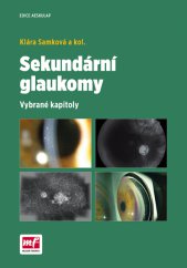 kniha Sekundární glaukomy Vybrané kapitoly, Mladá fronta 2016
