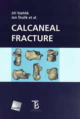 kniha Calcaneal fracture, Karolinum  2010