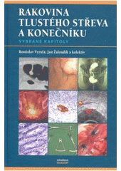 kniha Rakovina tlustého střeva a konečníku vybrané kapitoly, Maxdorf 2007