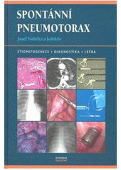 kniha Spontánní pneumotorax [etiopatogeneze, diagnostika, léčba], Maxdorf 2007