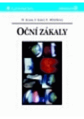 kniha Oční zákaly, Grada 2001