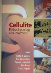 kniha Cellulite Pathophysiology and Treatment, Taylor & Francis Ltd 2006