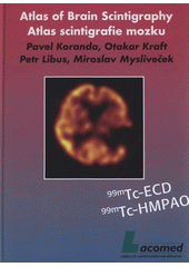 kniha Atlas scintigrafie mozku = Atlas of brain scintigraphy, Lacomed 2008