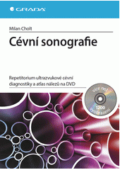 kniha Cévní sonografie, Grada 2013