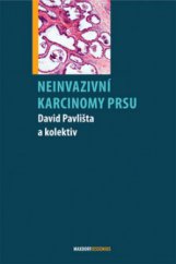 kniha Neinvazivní karcinomy prsu, Maxdorf 2008