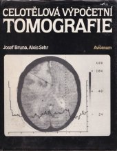 kniha Celotělová výpočetní tomografie, Avicenum 1988
