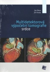 kniha Multidetektorová výpočetní tomografie srdce, Galén 2012