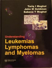 kniha Understanding Leukemias Lymphomas and Myelomas, Taylor & Francis Ltd 2006