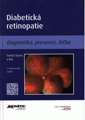 kniha Diabetická retinopatie diagnostika, prevence, léčba, Axonite CZ 2016