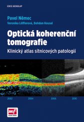 kniha Optická koherenční tomografie Klinický atlas sítnicových patologií, Mladá fronta 2015