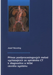 kniha Přínos postprocesingových metod vycházejících ze spirálního CT k diagnostice a léčbě cévního systému, Univerzita Palackého v Olomouci 2008