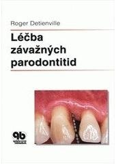 kniha Léčba závažných parodontitid, Quintessenz 2005