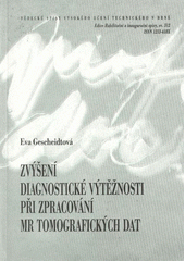 kniha Zvýšení diagnostické výtěžnosti při zpracování MR tomografických dat = Increasing the diagnostic yield while processing MR tomography data : teze přednášky k profesorskému jmenovacímu řízení v oboru Teoretická elektrotechnika, VUTIUM 2009