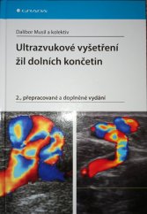 kniha Ultrazvukové vyšetření žil dolních končetin  2., přepracované a doplněné vydání , Grada 2016