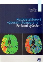 kniha Multidetektorová výpočetní tomografie Perfuzní vyšetření, Galén 2015