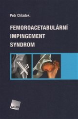 kniha Femoroacetabulární impingement syndrom, Galén 2016