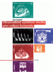 kniha Ultrazvukové vyšetření mozku přes velkou fontanelu, Triton 2000