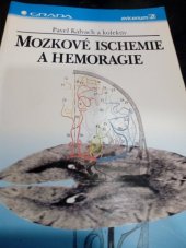 kniha Mozkové ischemie a hemoragie, Grada 1997