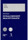 Intraluminární brachyterapie