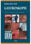 Gastroskopie