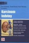 Karcinom ledviny