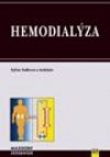 Hemodialýza