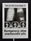Rentgenový atlas onemocnění plic