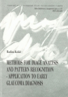 Methods for image analysis and pattern recognition - application to early glaucoma diagnosis =