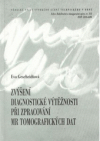 Zvýšení diagnostické výtěžnosti při zpracování MR tomografických dat =