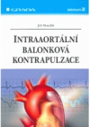 Intraaortální balonková kontrapulzace