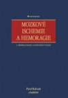 Mozkové ischemie a hemoragie