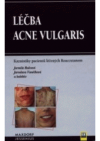 Léčba acne vulgaris