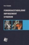 Femoroacetabulární impingement syndrom